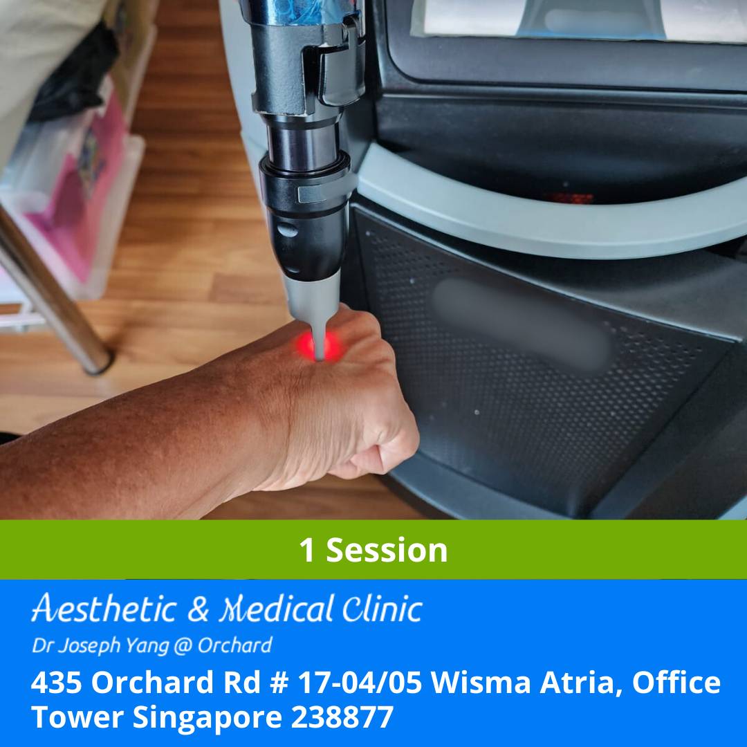 HAIR LASER REMOVAL - PICSURE/AXILLA / BRAZILLIAN, LONG PULSE / ARMS / LEGS (1 SESSION)