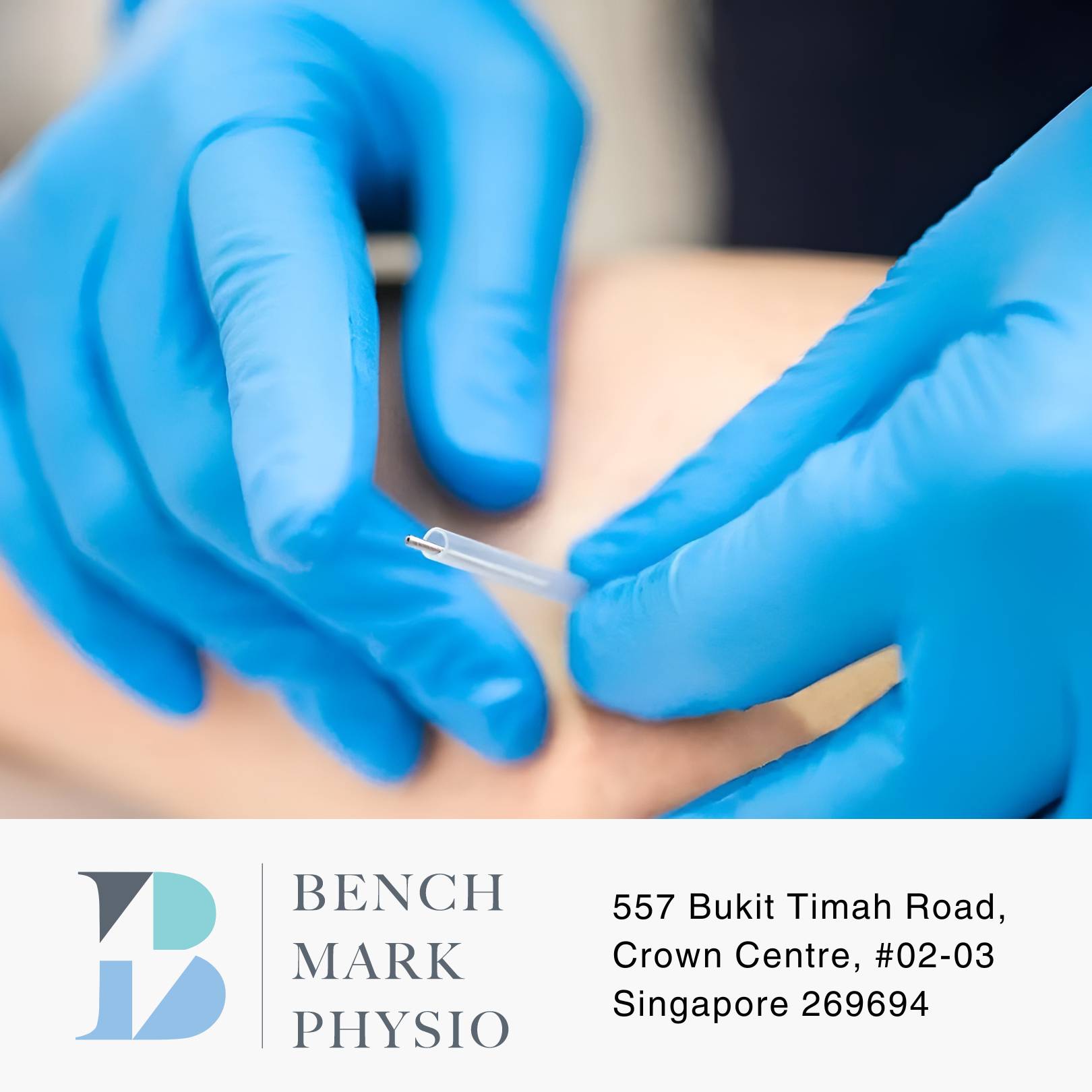 Benchmark Physio - Dry Needling (30 mins)