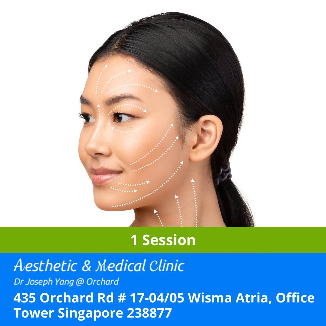 FACE FILLER - FACE LIFT, CHEEK LIFT, EYEBROW TEMPLE LIFT (FDA APPROVED) - 1 SESSION